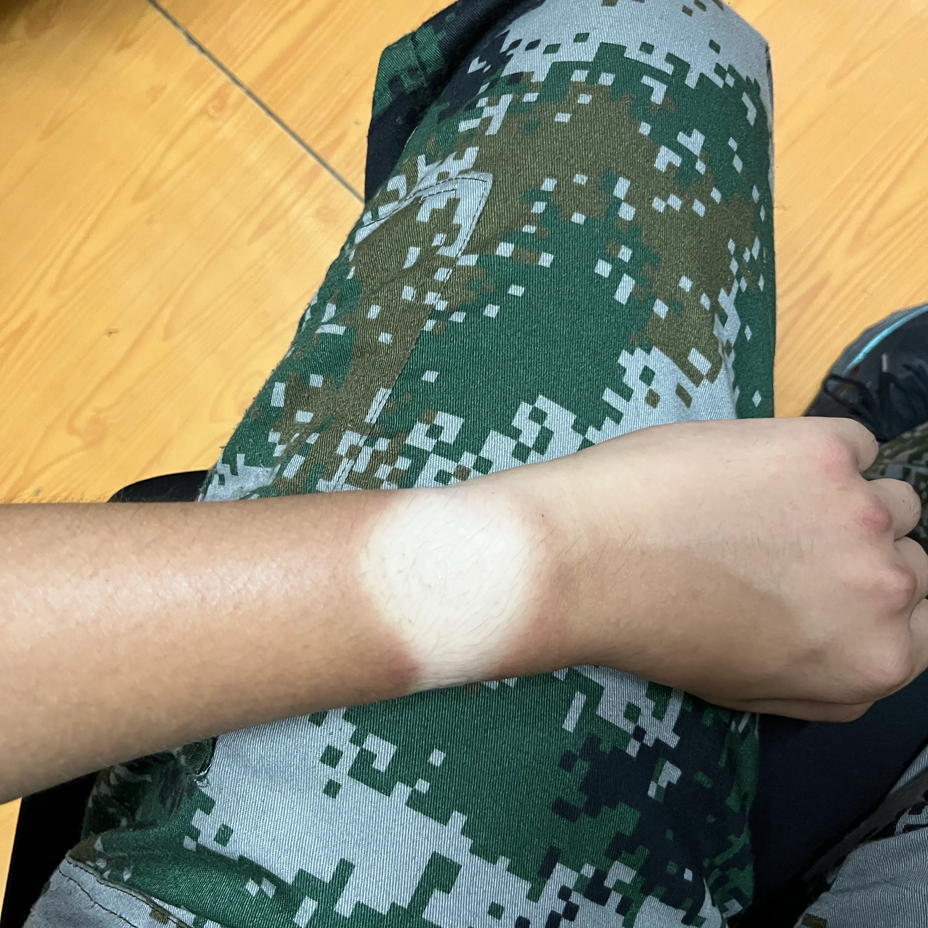 军训后的手表晒痕